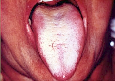lingua1