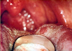 lingua3